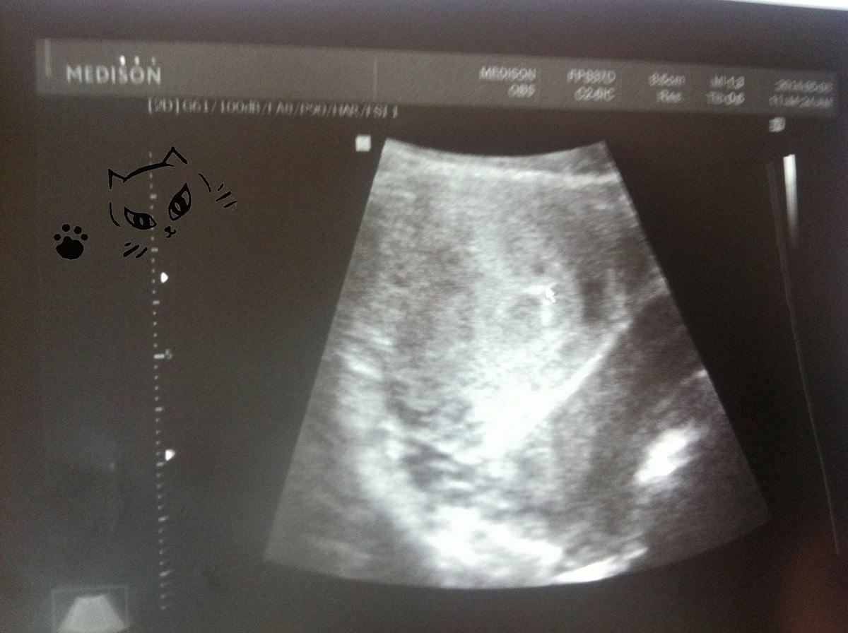 20241110-qdo8m 20241110-qdo8m